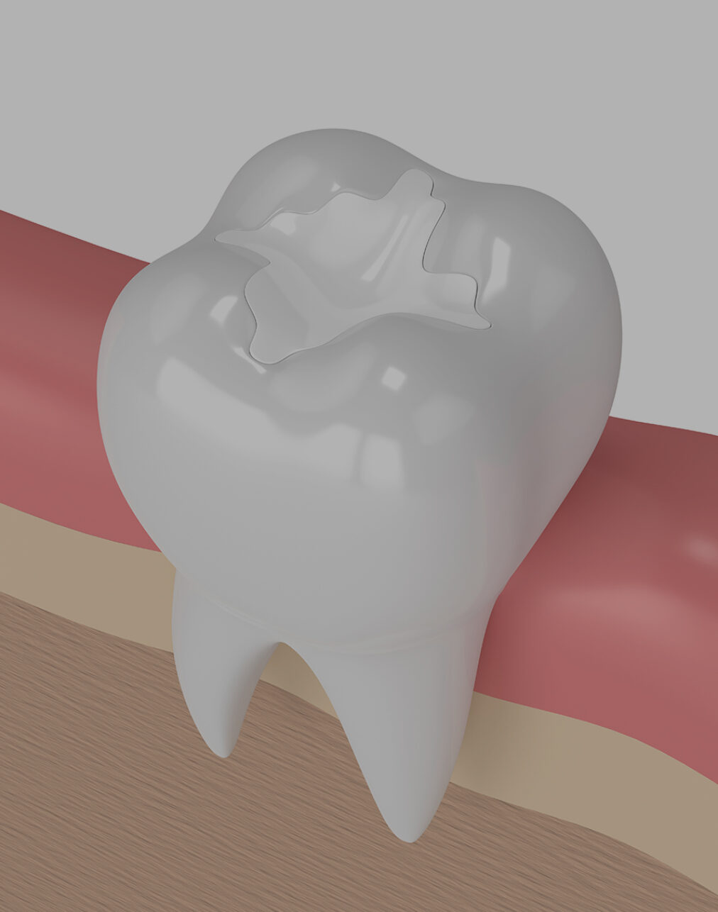 Treatment - West Street Dental